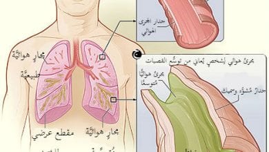 هل وجود الدم في البلغم عند الاستيقاظ مؤشر على وجود مرض خطير في الجسم ، أم لا داعي للقلق بشأنه