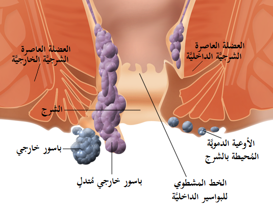 البواسير-مرهم فاكتو-طبيب العرب