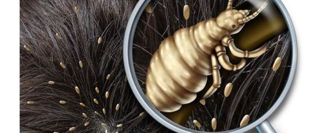 أدوية علاج القمل في مصر عدوى القمل و بعض أهم أدوية علاج القمل في مصر