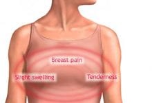كتلة في الثدي مؤلمة أثناء الرضاعة